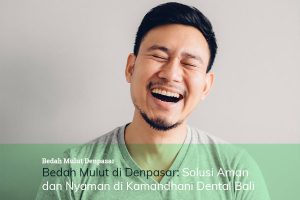 bedah mulut denpasar