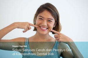 veneer gigi bali