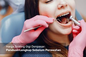 harga scaling gigi denpasar