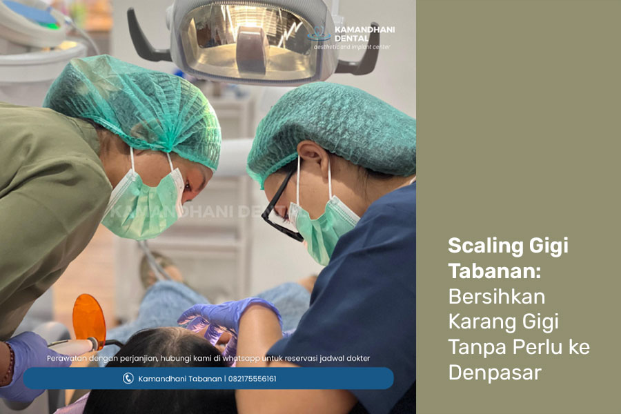 Scaling Gigi Terdekat di Tabanan: Bersihkan Karang Gigi Tanpa Perlu ke Denpasar