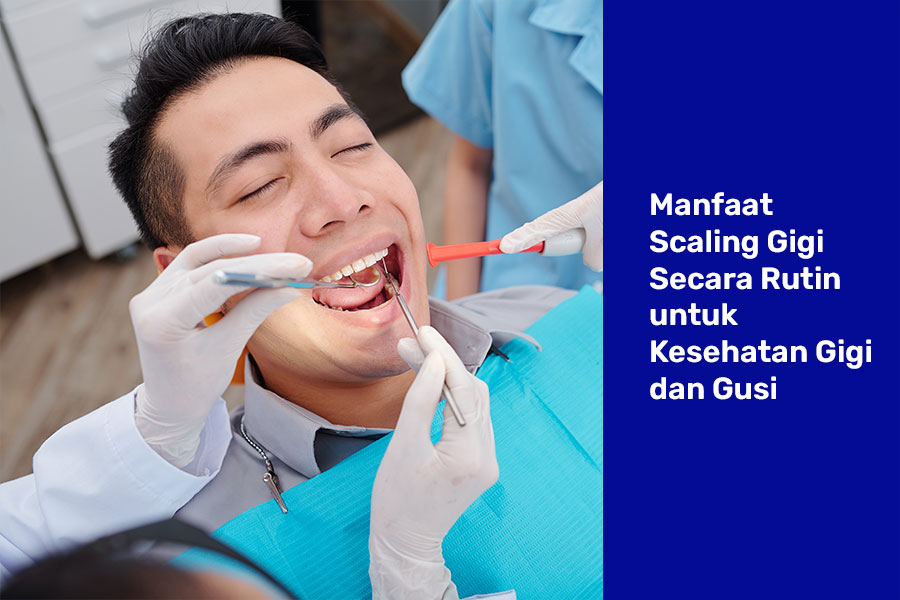 Manfaat Scaling Gigi Secara Rutin untuk Kesehatan Gigi dan Gusi